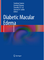 Diabetic Macular Edema.pdf